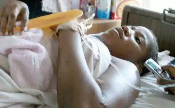 See What Happened To This Nigerian Woman that Woke Up In Mortuary 2Days After Dying In Accident